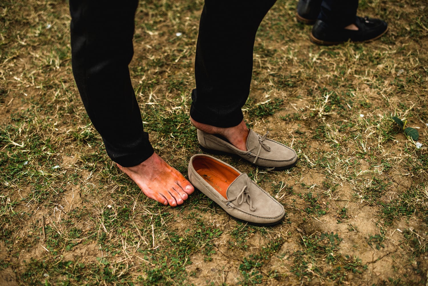 shoes turning feet orange